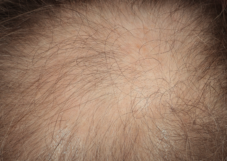 Variatie in haardikte