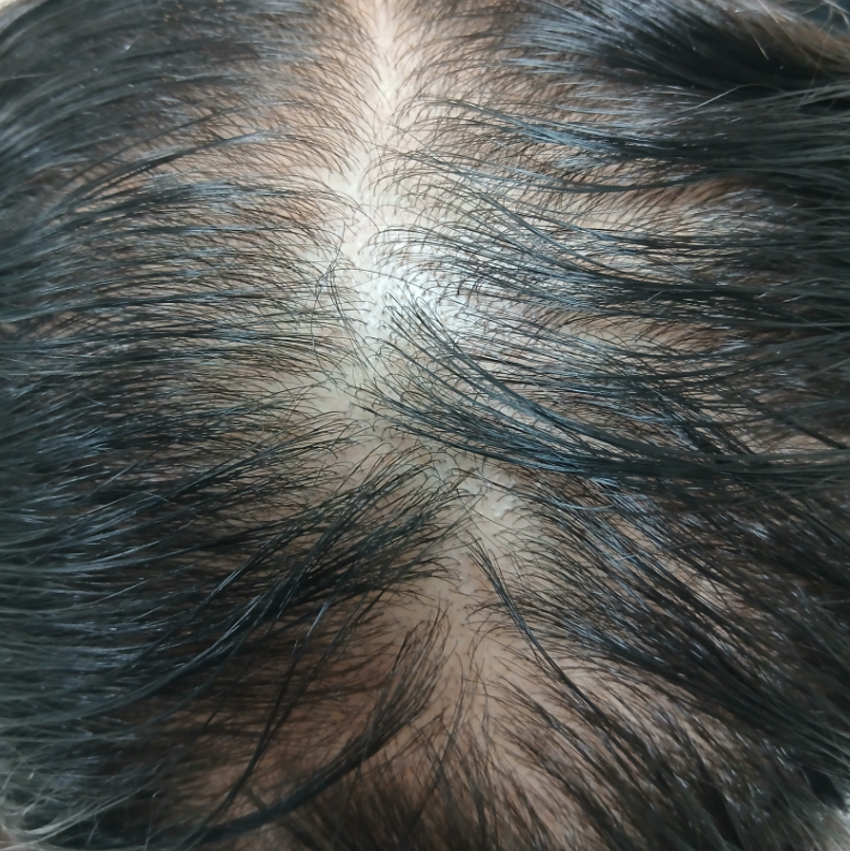 Kerstboomconfiguratie