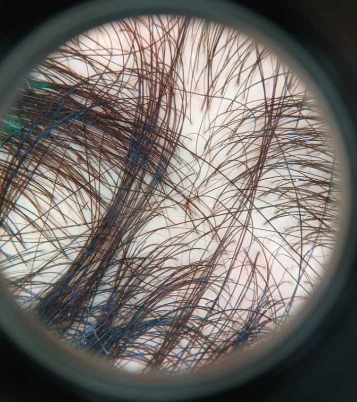 Variatie in haardikte